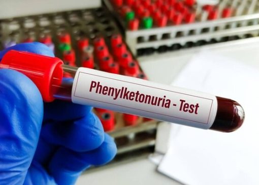 خبر خوش برای بیماران PKU؛ توزیع نان فاقد پروتئین