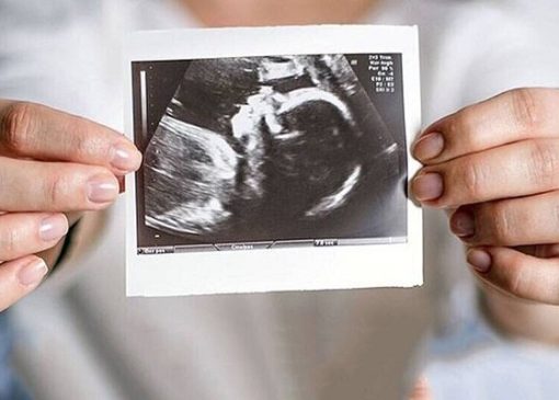 ویزیت رایگان مادران باردار ادامه دارد