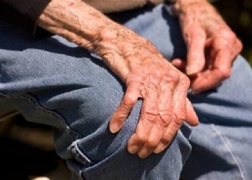 مشکل هورمون درمانی برای بیماران جراحی مفصل زانو