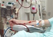 هورمون درمانی برای همه بیماران سرطان پروستات ضروری نیست