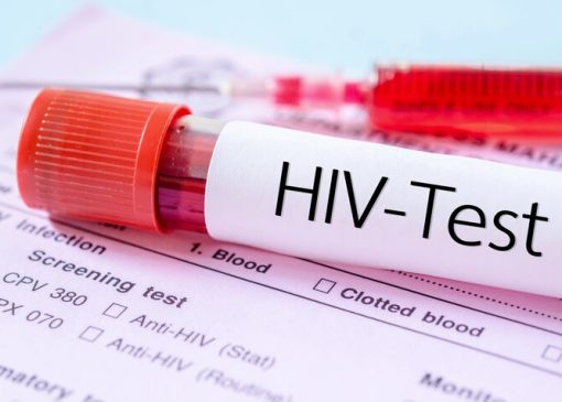 مهم‌ترین چالش امروز HIV در ایران